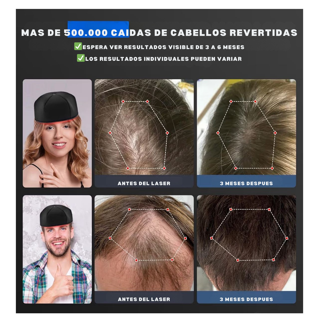 GORRO DE LUZ LED, ESTIMULADOR CAPILAR DESDE LA RAIZ