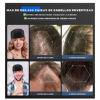 GORRO DE LUZ LED, ESTIMULADOR CAPILAR DESDE LA RAIZ